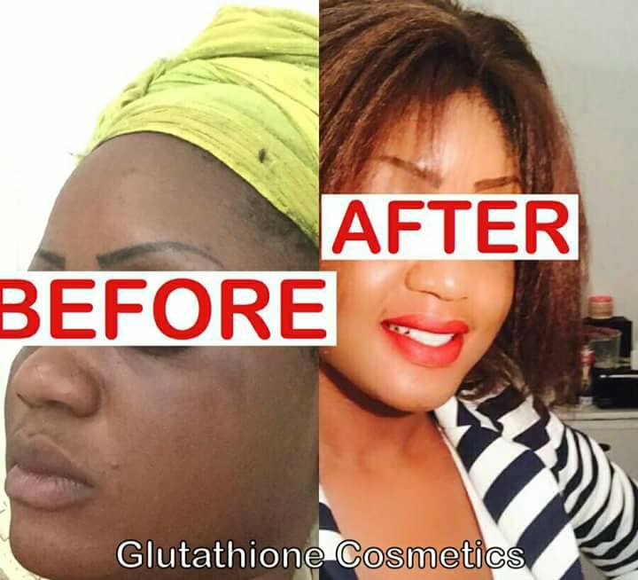 Belle Nubian Glutathione (@doyinnolabellenubian) • Facebook