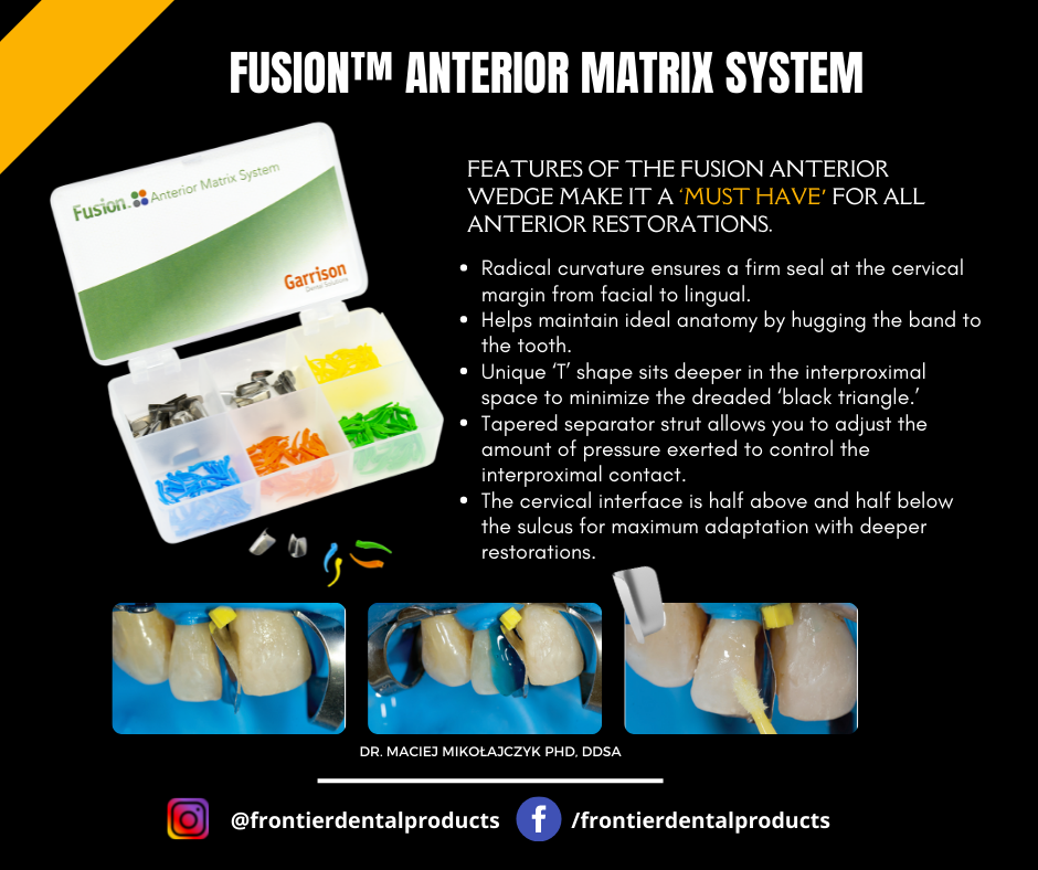 The all-new Fusion™ Anterior... - Frontier Dental Products | Facebook