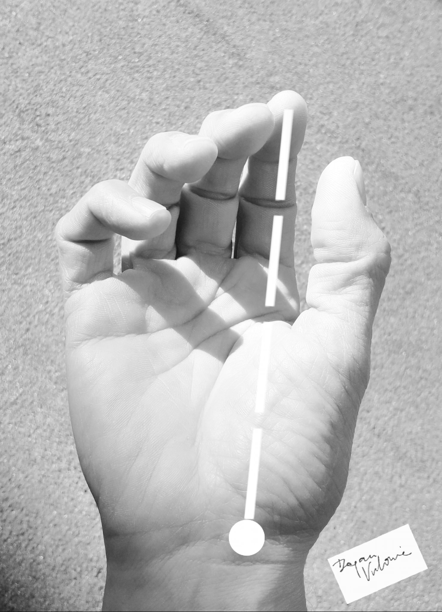 Postural position of... - Serbian Society for Hand Surgery
