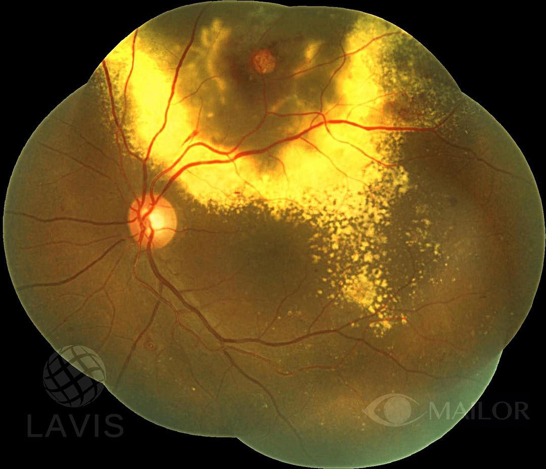 Mailor / Mexican Advanced Imaging Laboratory For Ocular Research ...