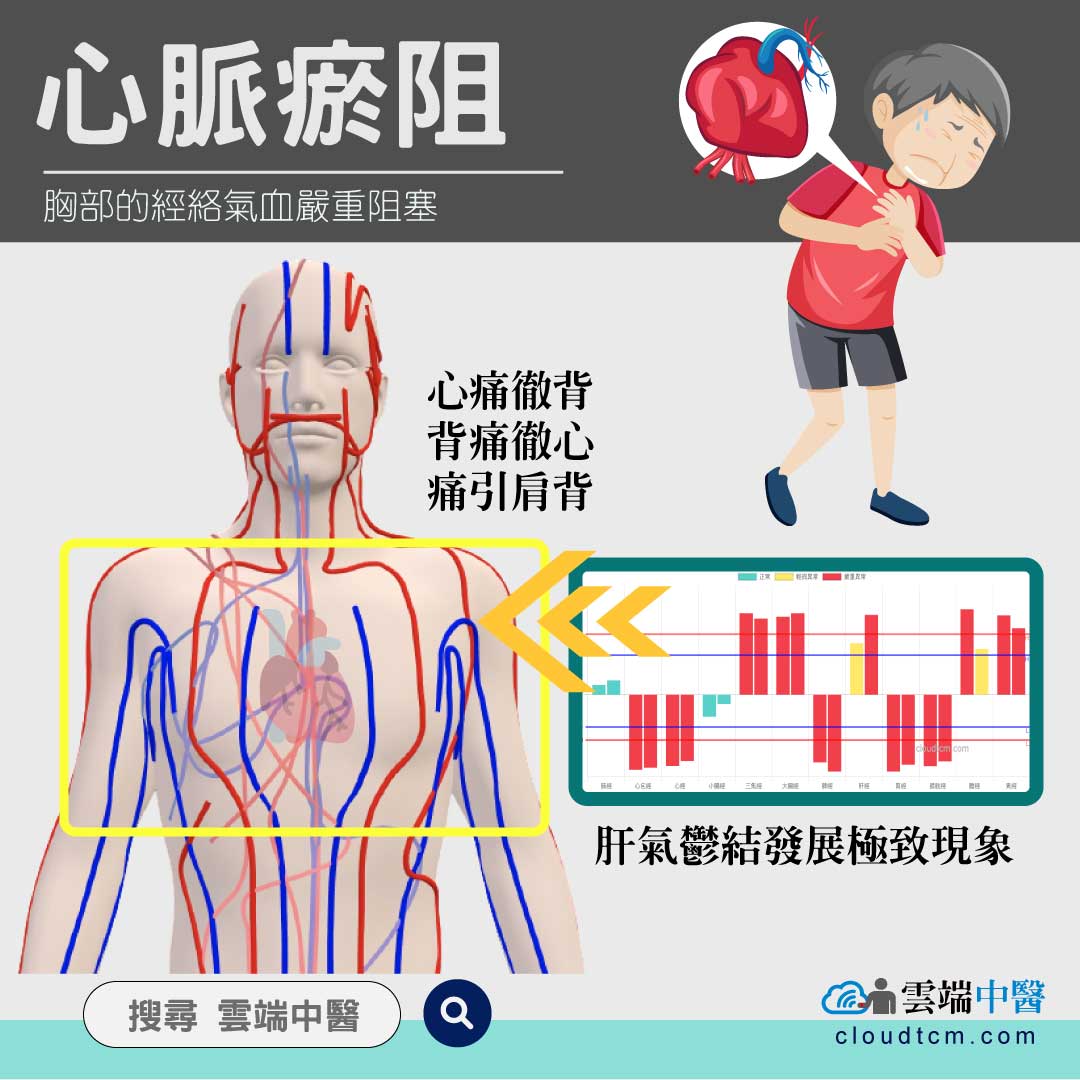 雲端中醫 - 本月份心經與心包經高機率虛證，容易出現「心脈痹阻證」，有些人會嚴重到「心痛徹背，背痛徹心」或是「痛引肩背... | Facebook