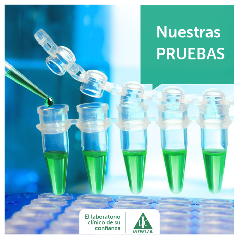 INTERLAB - #INTERLAB está en capacidad identificar al... | Facebook