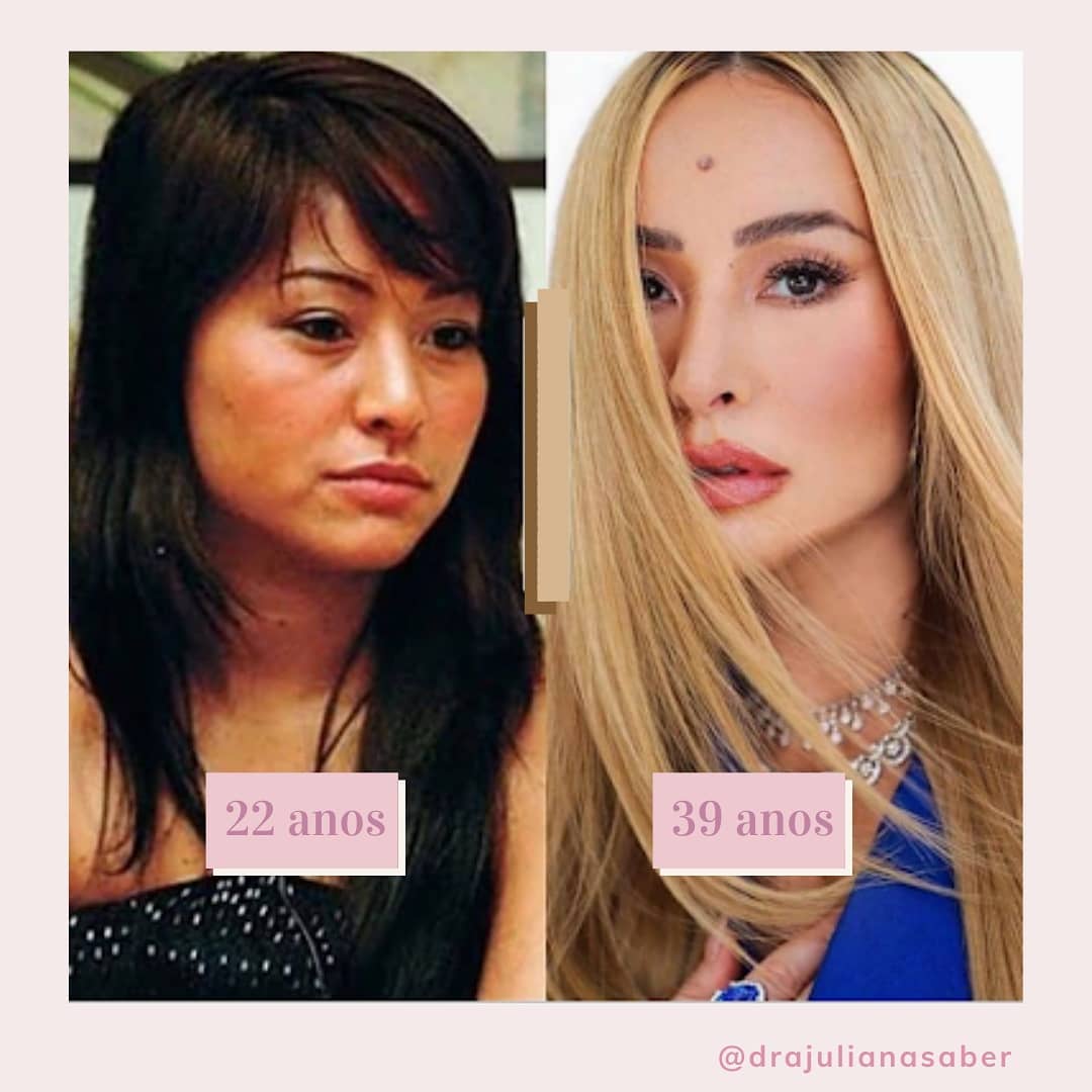 Botoxin Box - 🌸Esse antes e depois da Sabrina Sato resume...