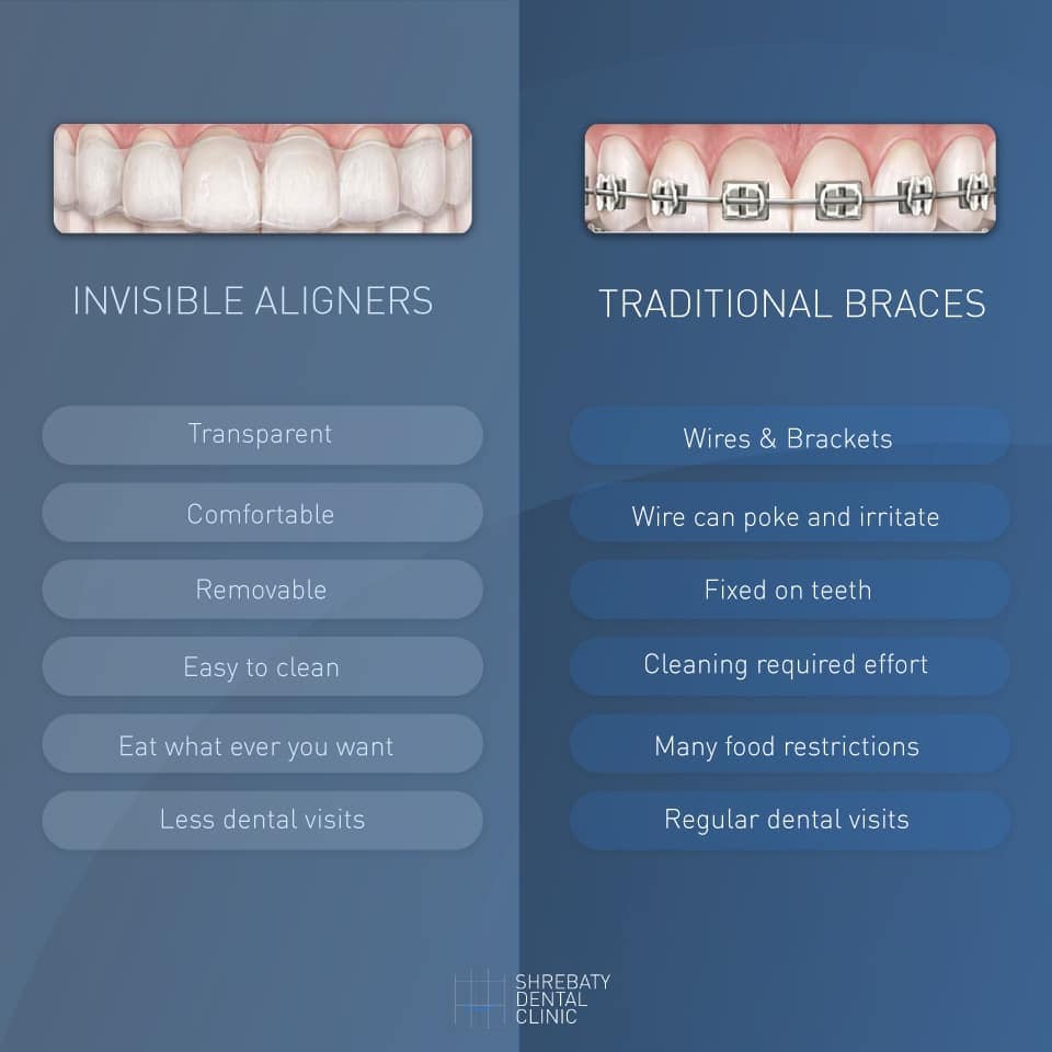 INVISIBLE ALIGNERS VS Braces... - Shrebaty Dental Clinic