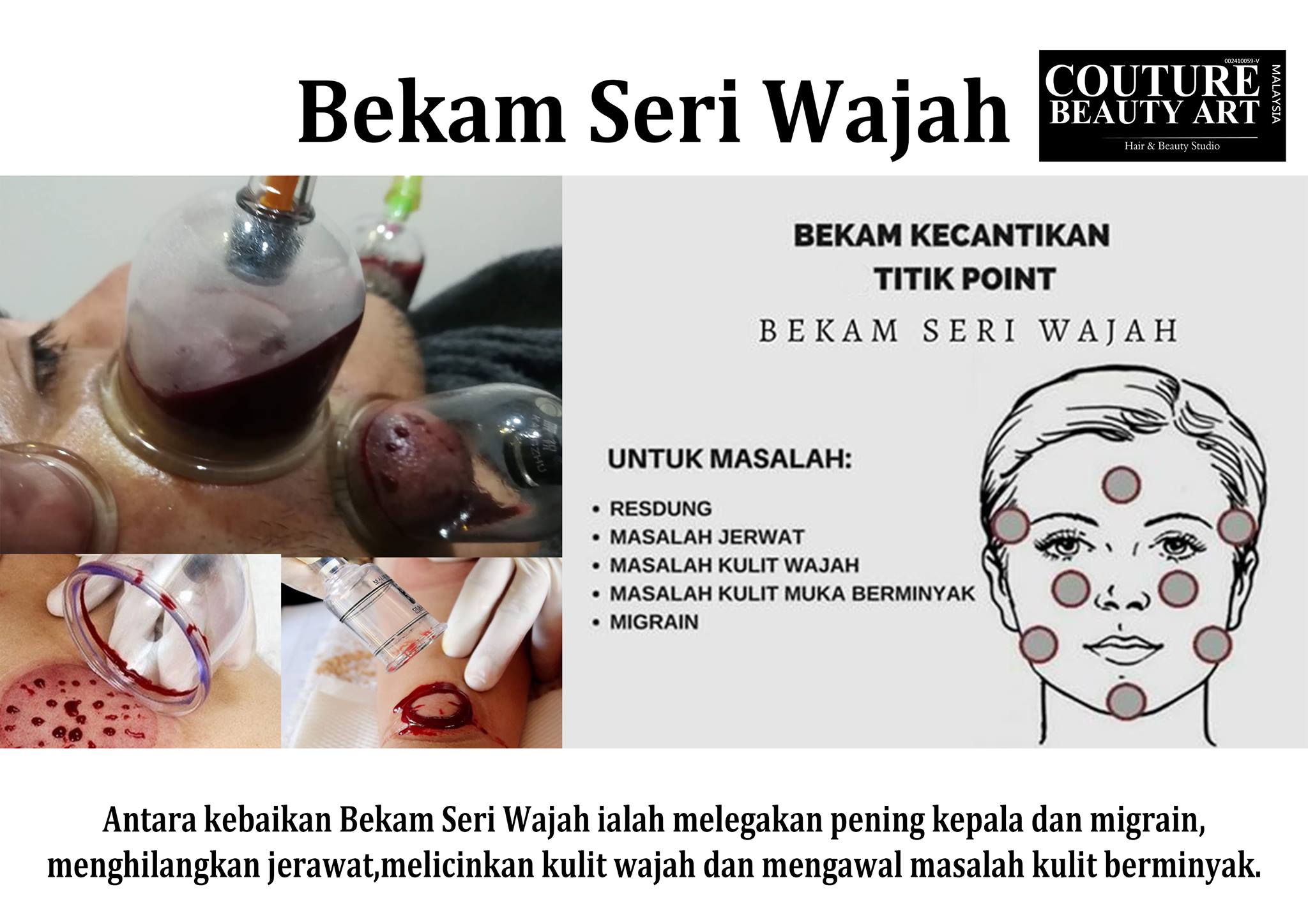 Antara Kebaikan Bekam Seri Wajah Couture Beauty Art Kl Facebook