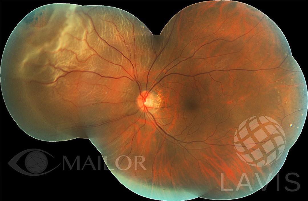 Mailor / Mexican Advanced Imaging Laboratory For Ocular Research ...