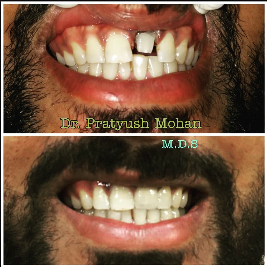 Pearl Dental Clinic & Implant Centre | Bhajanpura