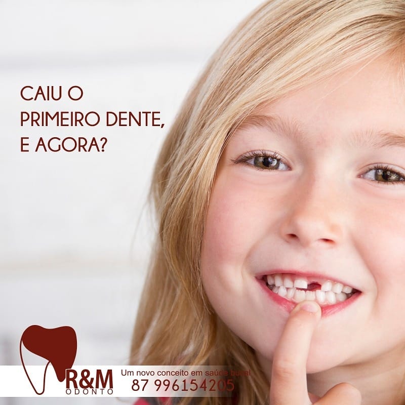 R&M - Conhecido como terceiro molar, o dente do siso, também nasce ...