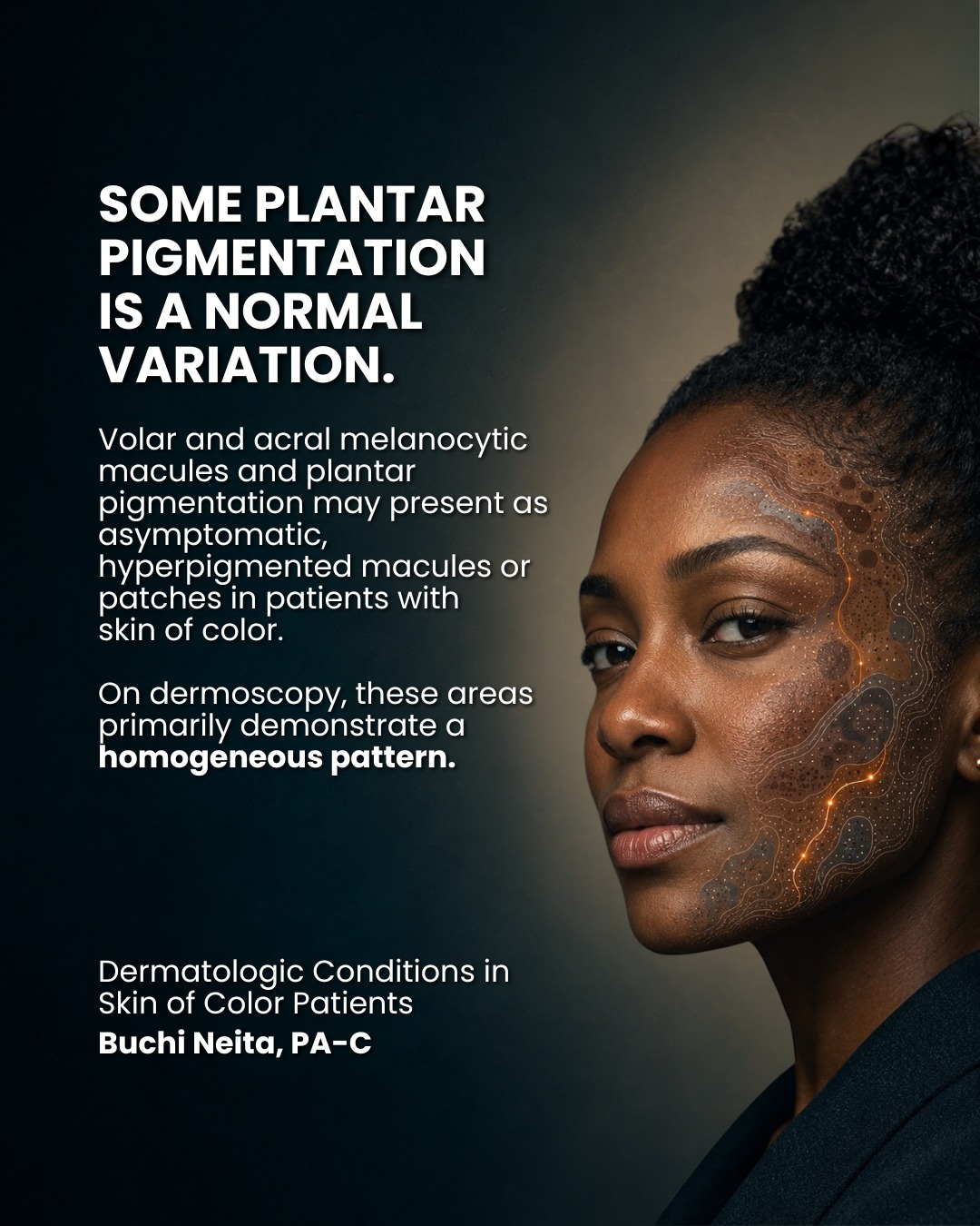 volar melanotic macules Understanding hyperpigmentation diagnosis and treatment in dermatology Choose your pack:Pack of 1 (30 tablets) Heart Palpitations: Causes, Symptoms SPF 50 body cream