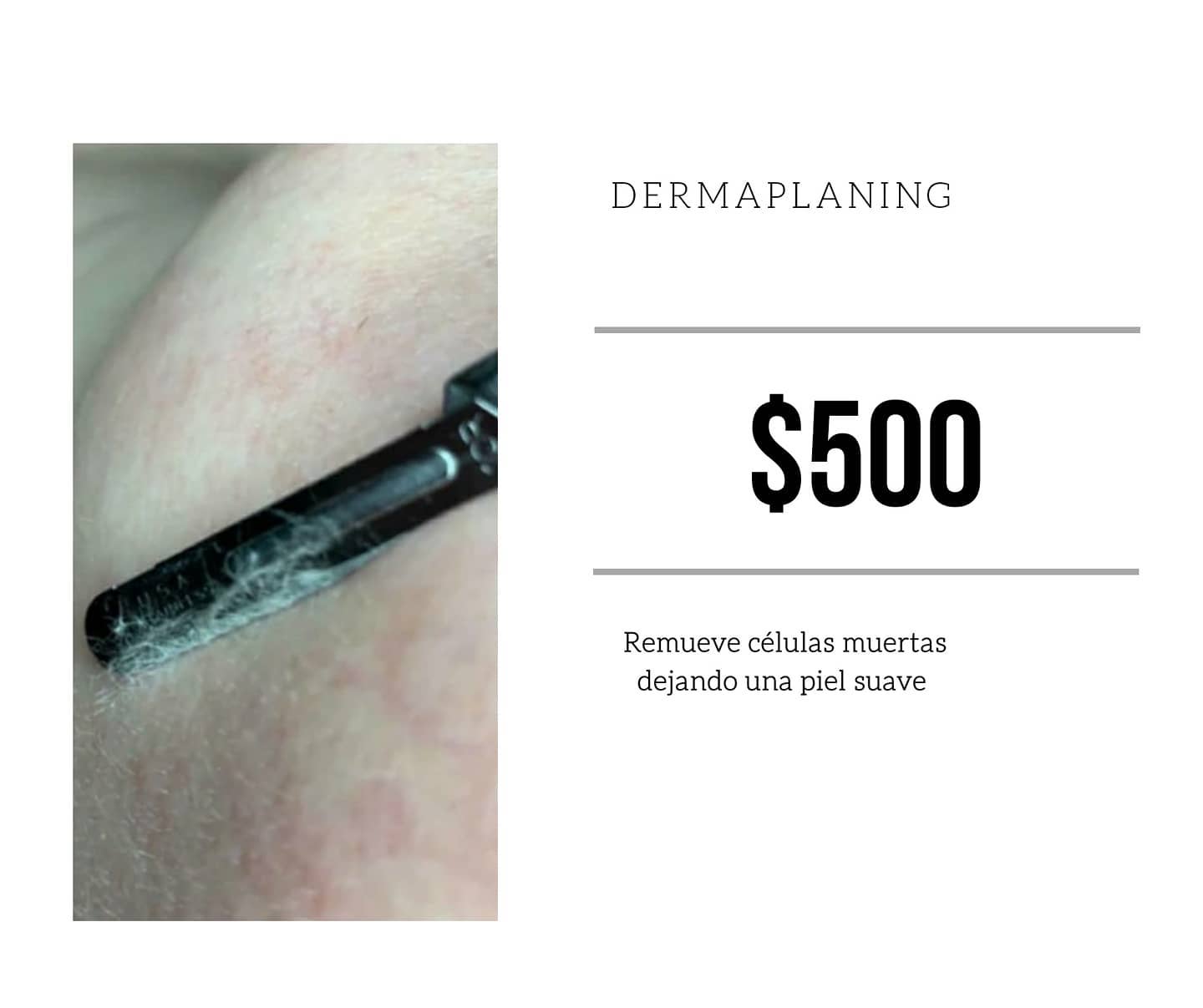 Jonathan Rizzi - El Dermaplaning es un método de... | Facebook