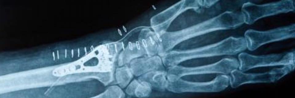 Association of Trauma and Orthopaedic Chartered Physiotherapists - ATOCP