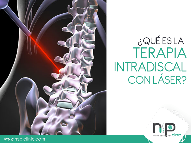 La terapia Intradiscal con... - Neuro Spine & Pain Clinic