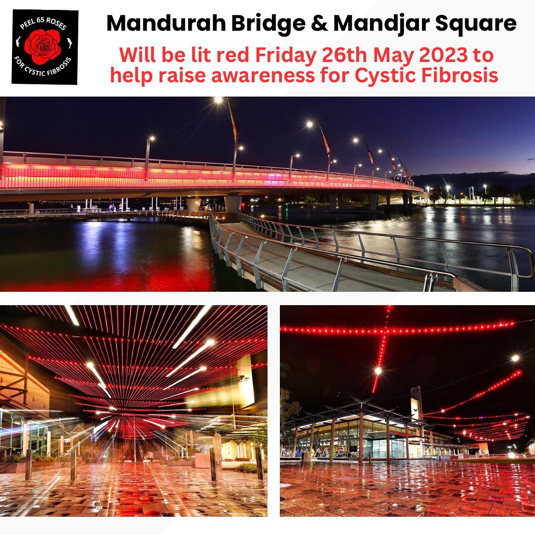 Peel 65 Roses for Cystic Fibrosis | Mandurah WA