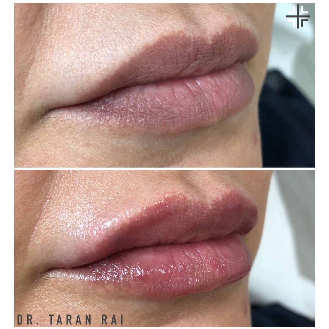 Dr Taran Rai