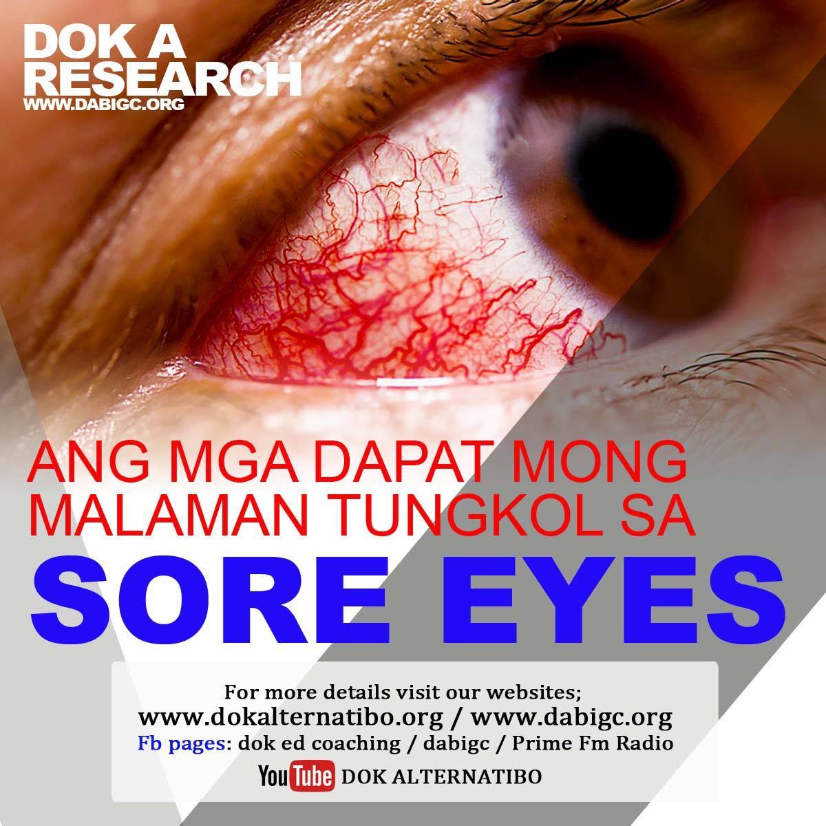 Dok A Research - ANG MGA DAPAT MONG MALAMAN TUNGKOL SA SORE EYES Ang ...