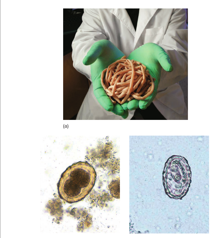 Intestinal Nematode , Ascaris... - Medical science- Cambodia | Facebook