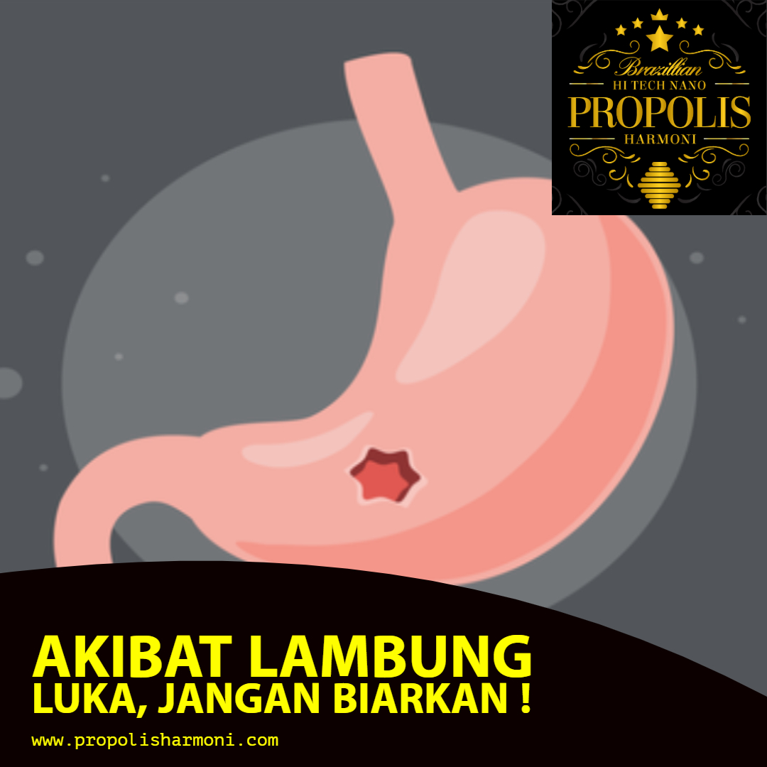 Penyakit Maag Disebabkan Kebiasaan Makan Yang Tidak Teratur Akibatnya