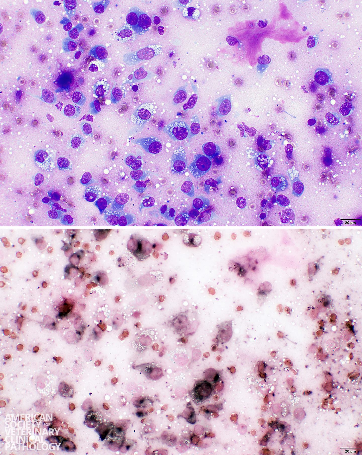 Epidermal Inclusion Cyst Cytology Dog