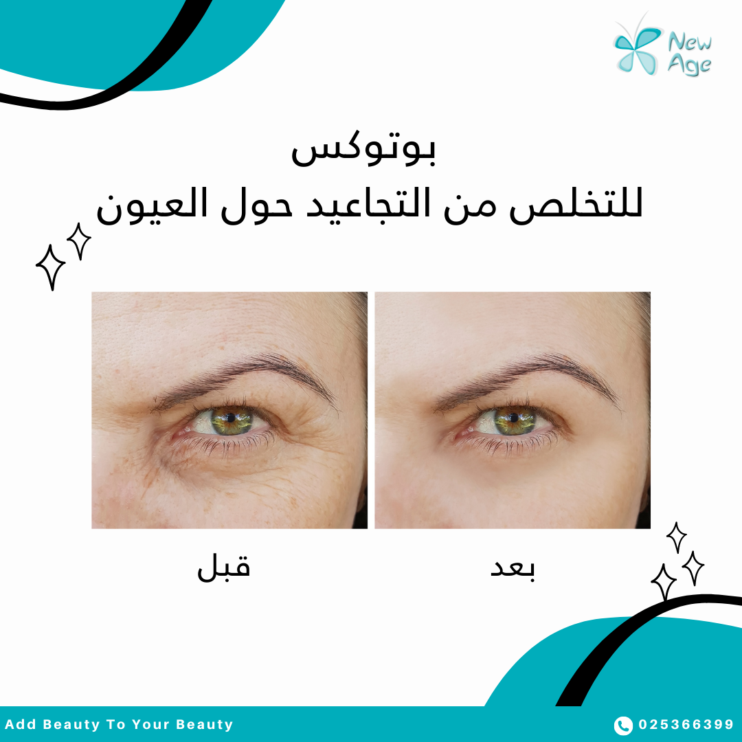 new-age-jerusalem-aesthetic-beauty-center