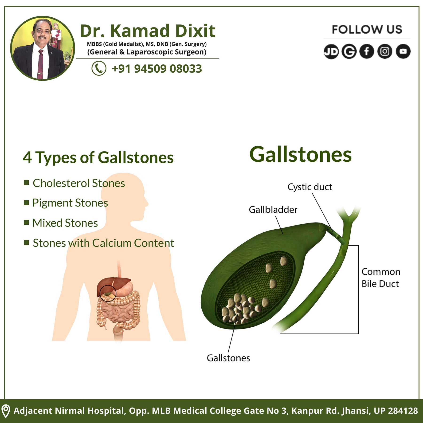 dr-kamad-dixit-four-types-of-gallstones-cholesterol