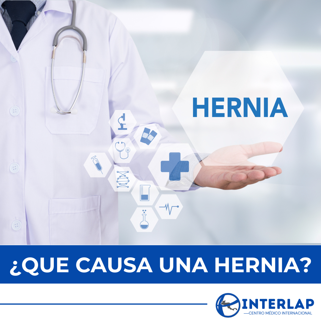 Las hernias... - Interlap - Centro Médico Internacional | Facebook