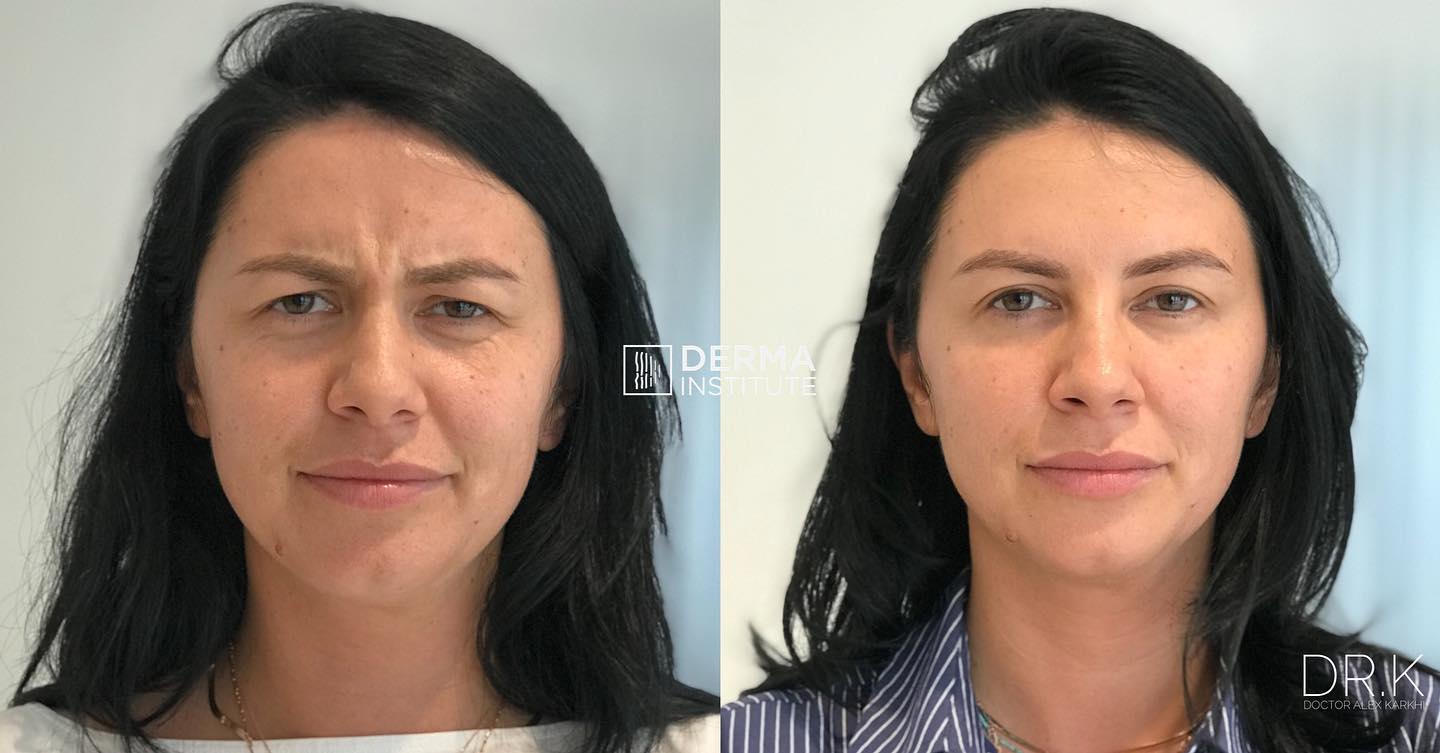 Derma Institute - 💉 Master the ‘Art of Botox’ and start...
