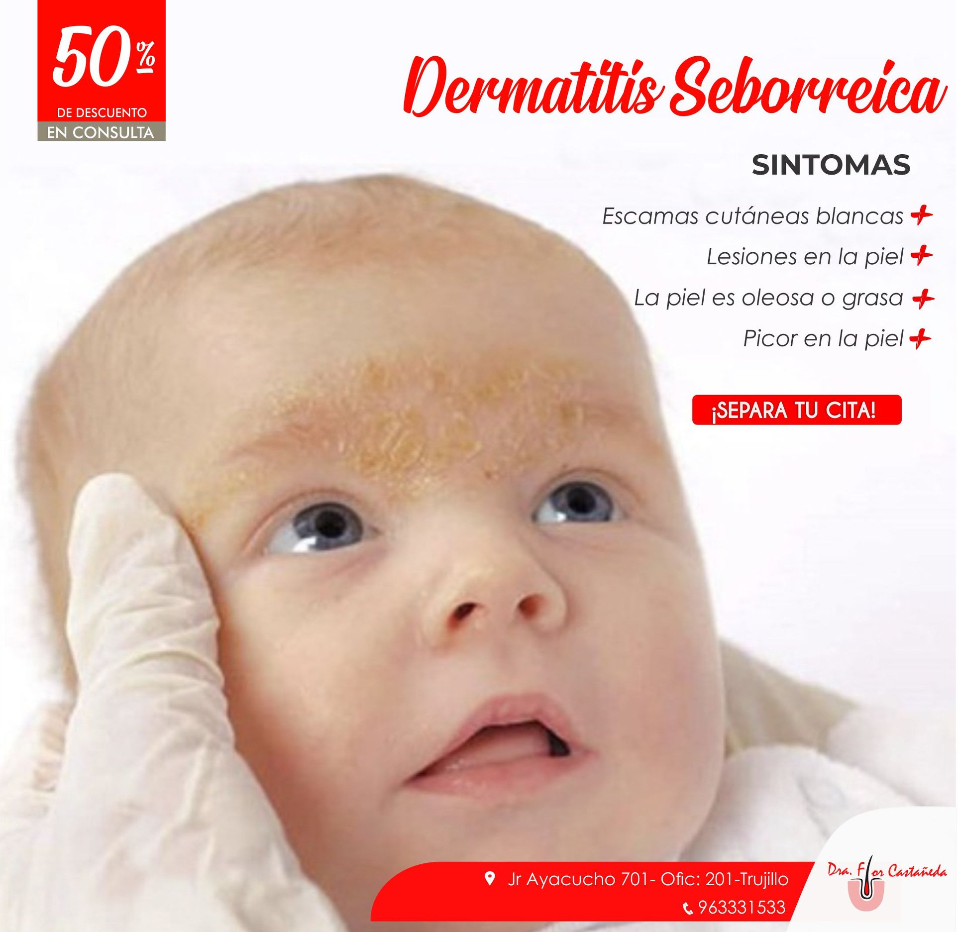 📣👩‍⚕️La dermatitis seborreica es un trastorno frecuente de la piel, que ...