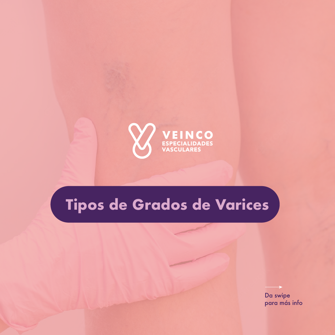 Existen diferentes... - Veinco Especialidades Vasculares | Facebook