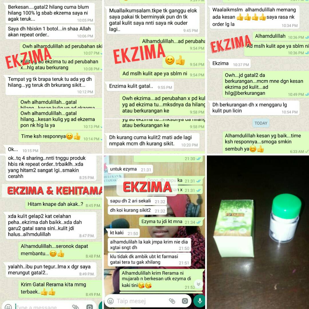 Krim Gatal Rerama Hb Tabib | Butterworth