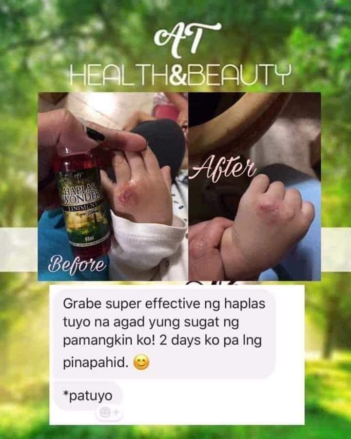 HAPLAS LINIMENT FEEDBACK: Ilang... - Jannarah Beauty Products