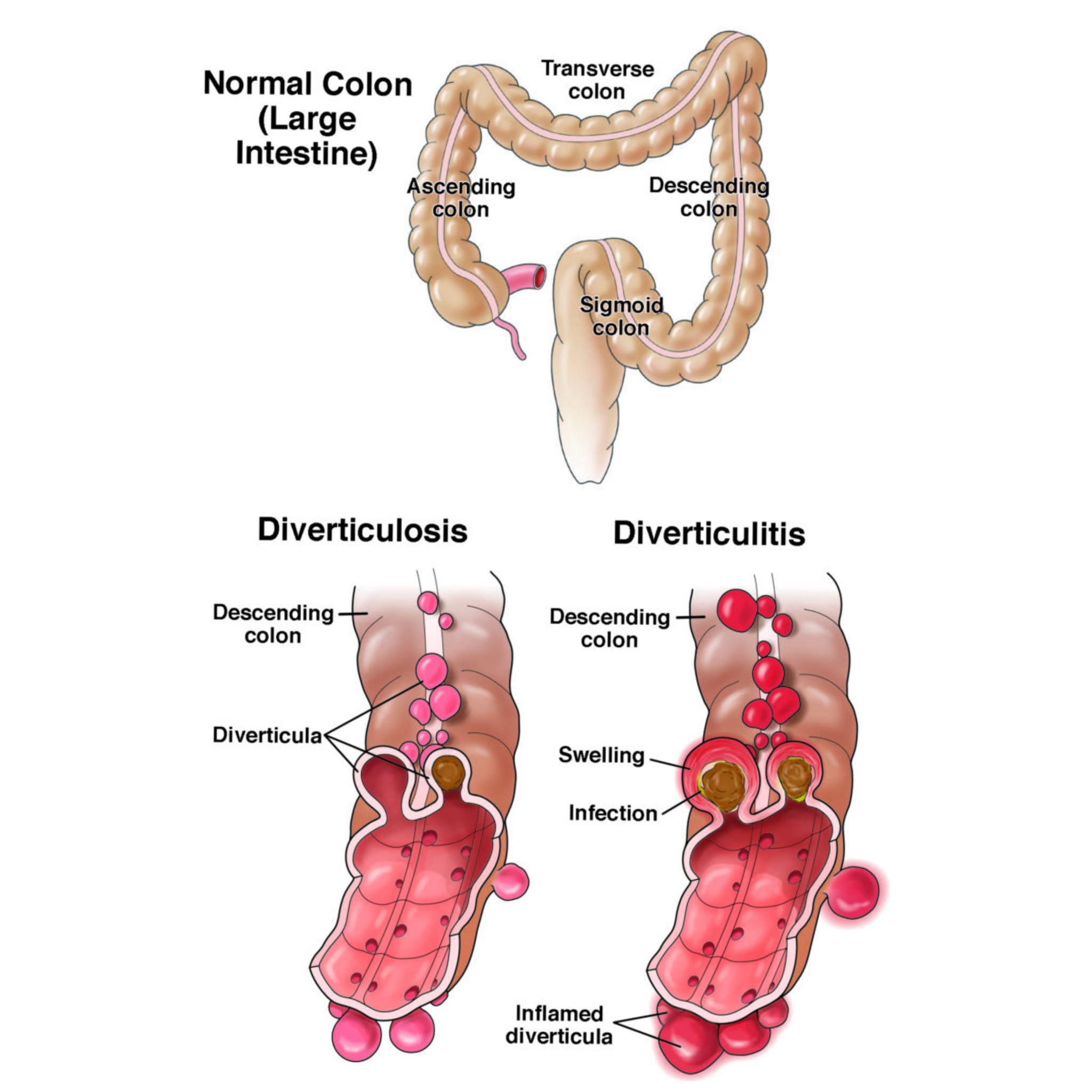 does bcbs cover tirzepatide for weight loss Blue Cross Blue Shield Insurance Surgery How Do Semaglutides Work Medicine/Drug form:15mg/2ml Luxer Urgent Care