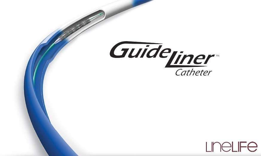 O GuideLiner é um cateter de... - Line Life Cardiovascular | Facebook