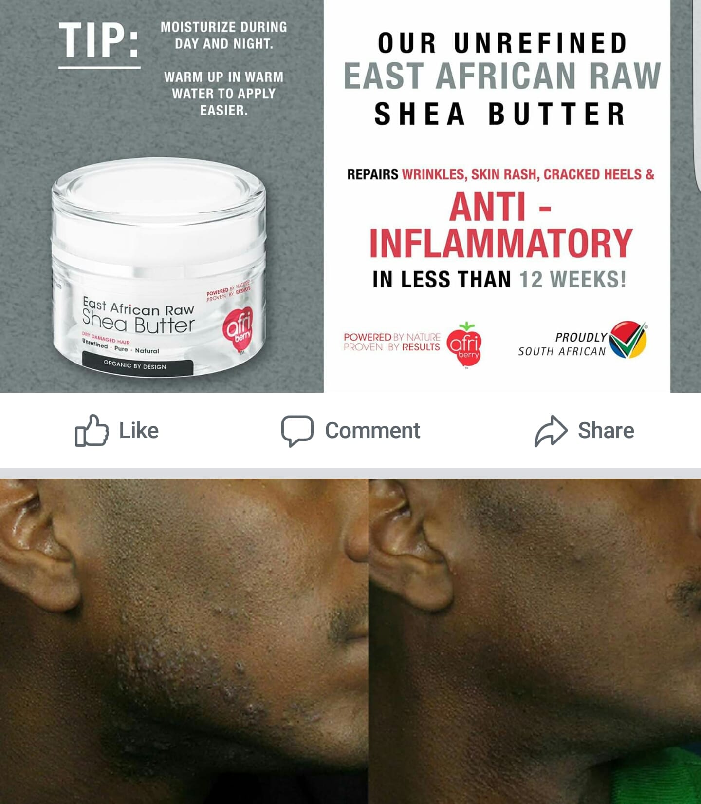 SKIN RASH SOLUTION? USE AFRI-BERRY... - Fine Pharmaceuticals | Facebook