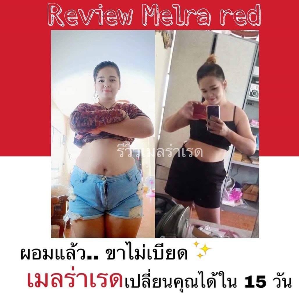 ลูกค้าหลังคลอดน้ำหนักค้าง 2 ปี... - Melra red ปั้นหุ่นสวย