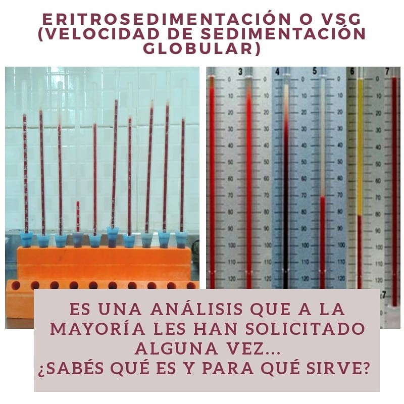 ️ La Eritrosedimentcion o VSG es... - Laboratorio SIL S.A | Facebook