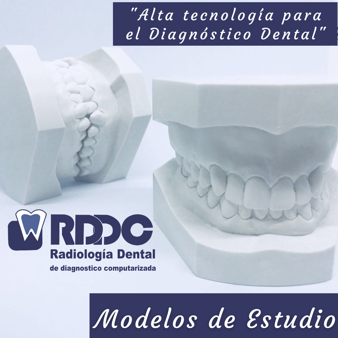 Los... - RDDC Radiología Dental de Diagnóstico Computarizada | Facebook