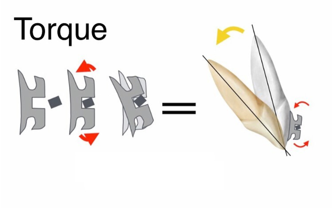 Hablemos de TORQUE 👉 el torque es... - Ortodoncia Corrientes