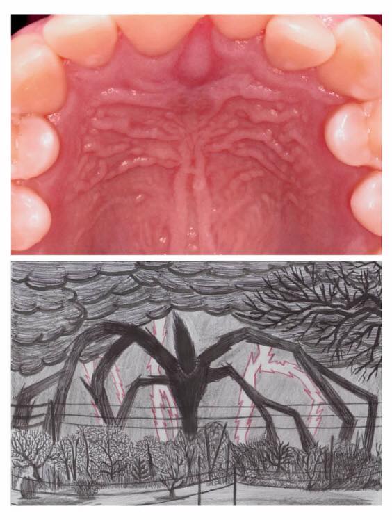 Have you seen the Stranger... - Dr. James Dental Clinic
