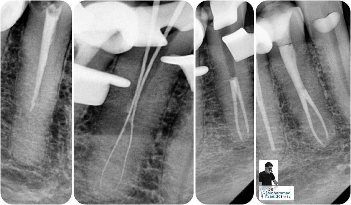 If i have to do my RCT with only 1... - Dr Mohammad Saeid | Facebook