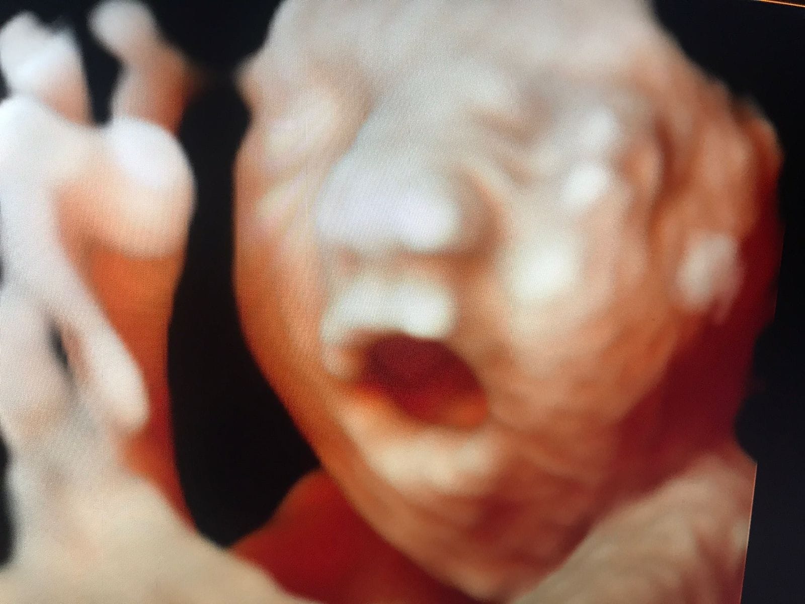 Some super cute babies we scanned... - Life Scan Studio