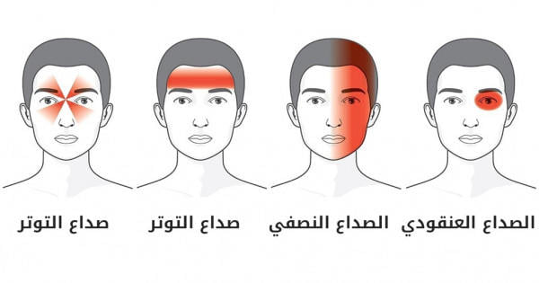 الصداع في مثل هذه الحالات صحيفة التيار السودانية فيسبوك