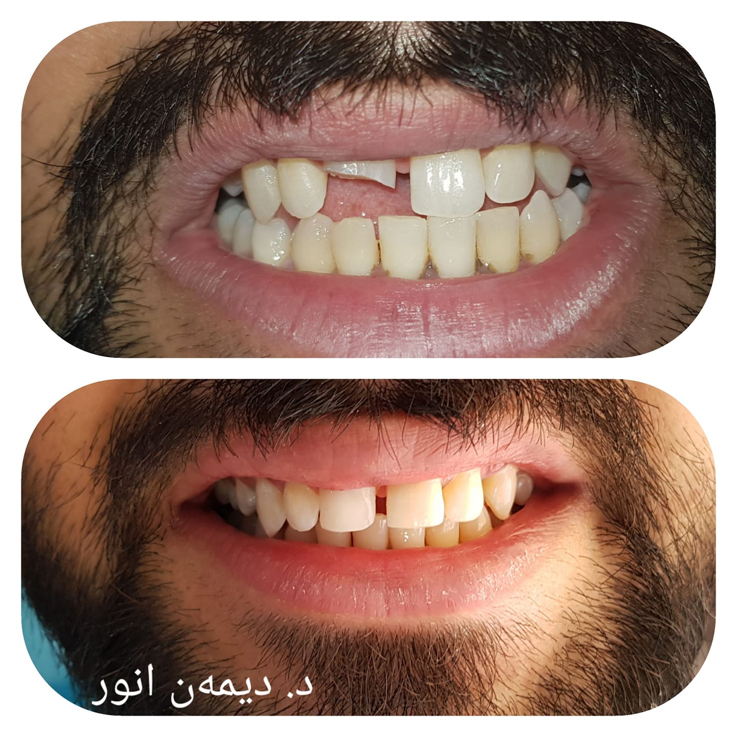 پزیشکی ددان - ئێستا دەتوانن نۆرە وەربگرن ژ.ت 07503509492...