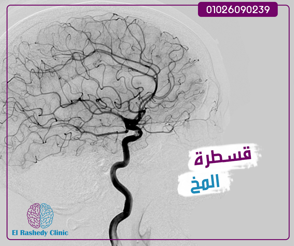 من أهم النقاط الجديده في مجال المخ والأعصاب هو 