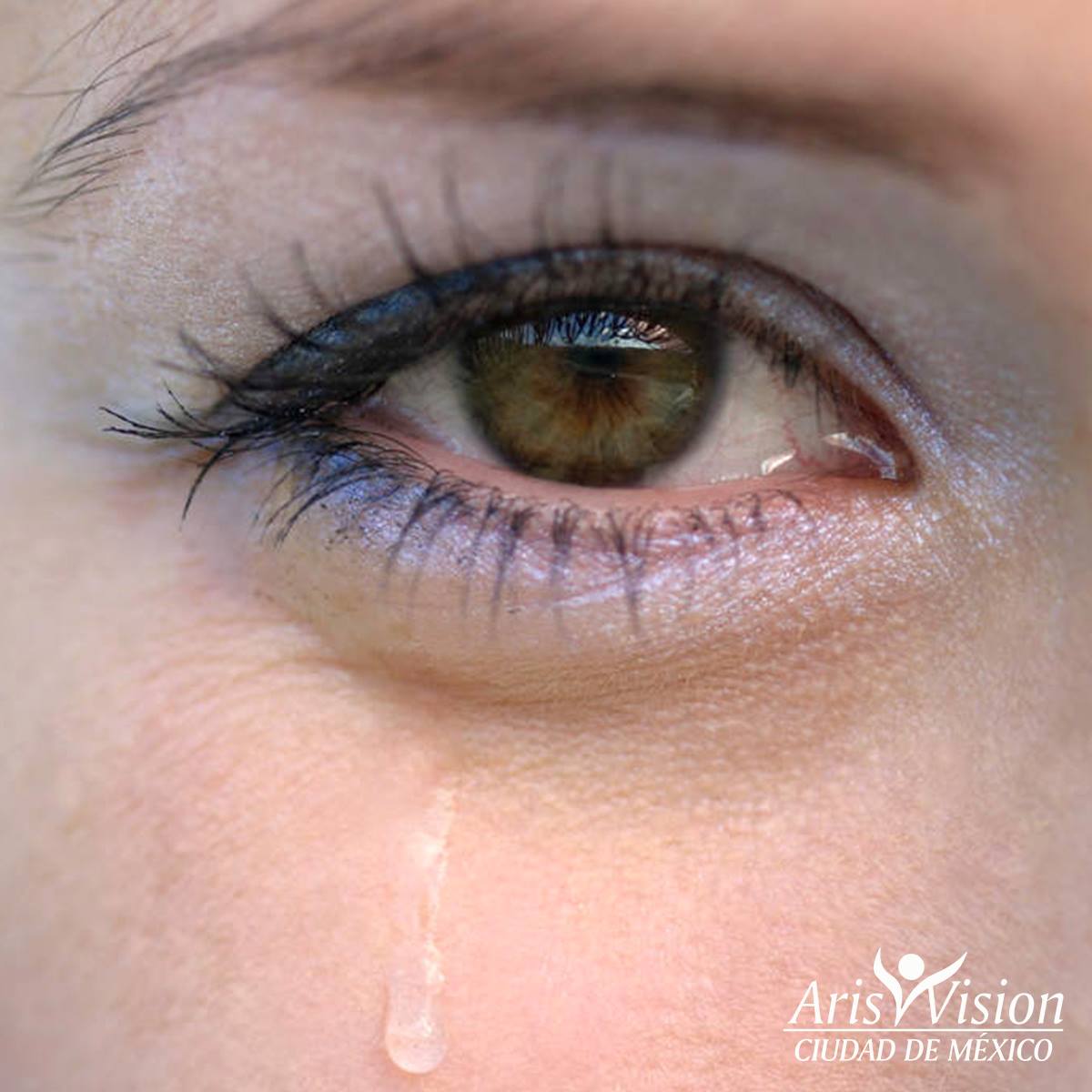 ¿Tus ojos lloran y no sabes por qué?... - Aris Vision CDMX | Facebook