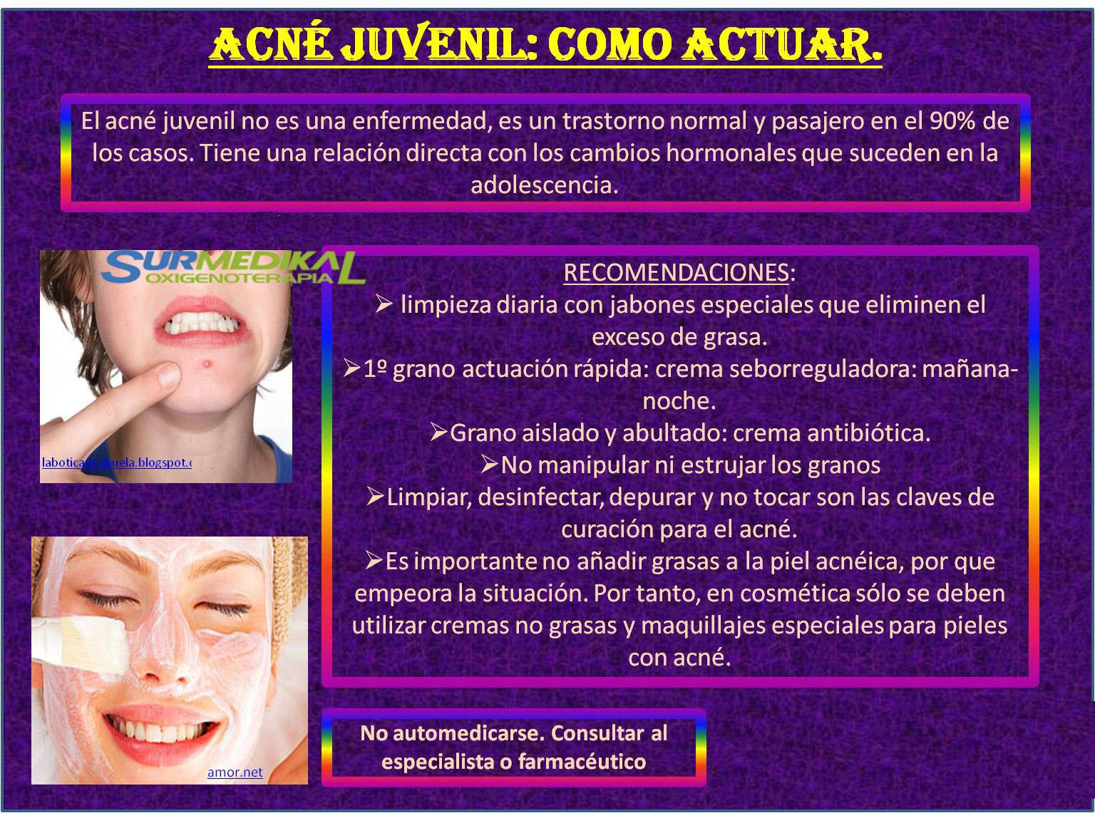 Surmedikal Oxigenoterapia - ACNE JUVENIL Esta enfermedad, propia de la ...