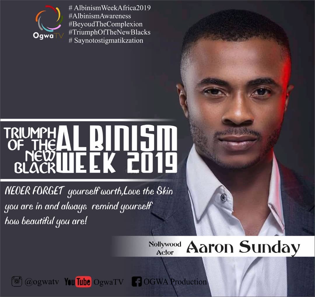 Aaron Sunday. - #Repost @ogwatv • • • • • • #ALBINISMWEEKAFRICA2019 ...