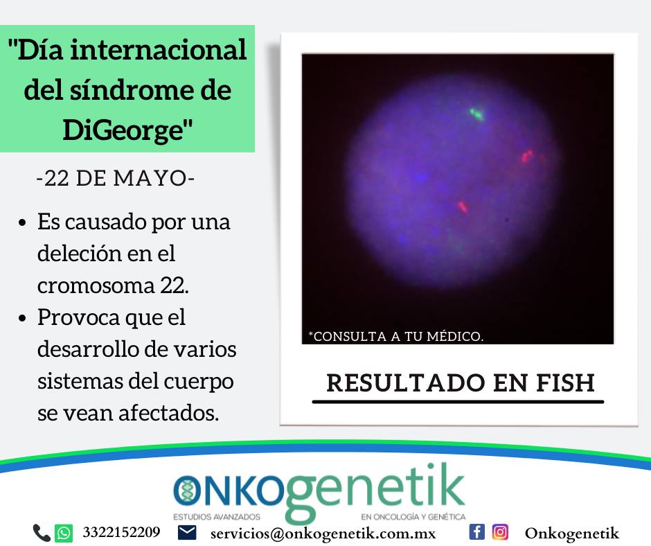 Onkogenetik - Hoy es el día internacional del síndrome de DiGeorge. Se ...