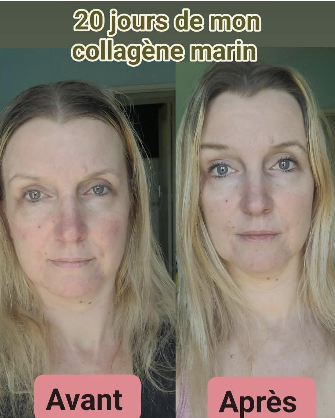 glutathione whitening pills skin reviews 5 Best Supplements in 2026 Offer:Cream vitamin b12 1000mcg injection Shop By Health Concern