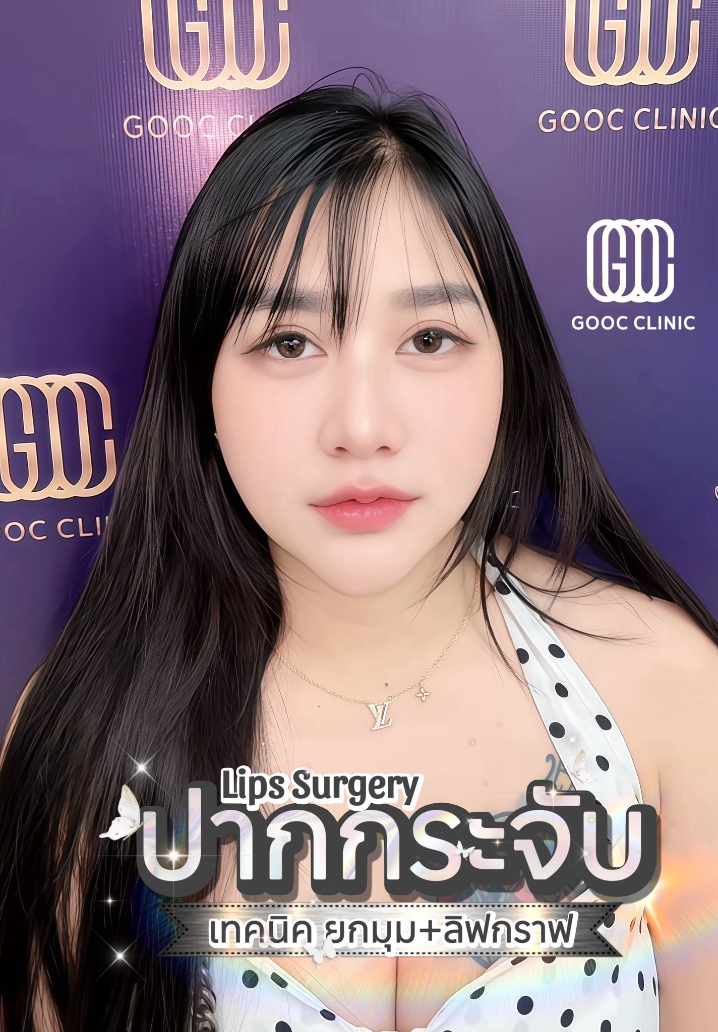 Gooc... - Gooc clinic คลินิกศัลยกรรม:ความงามยโสธร-ชัชวาลคลินิก