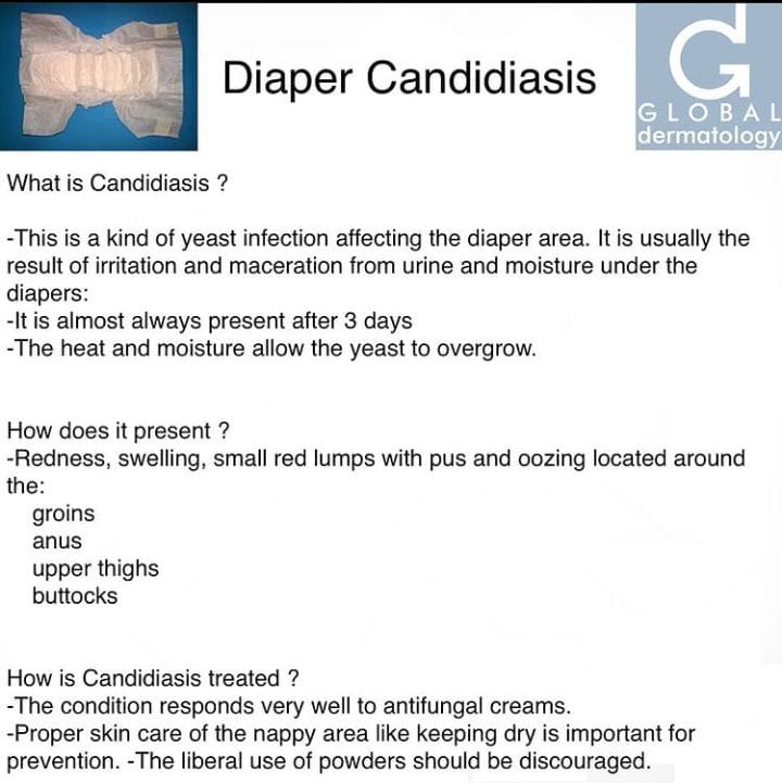 Diaper Candidiasis... - Global Dermatology - Christophe HSU MD ...